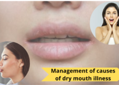 What is dry mouth illness, and possible causes?